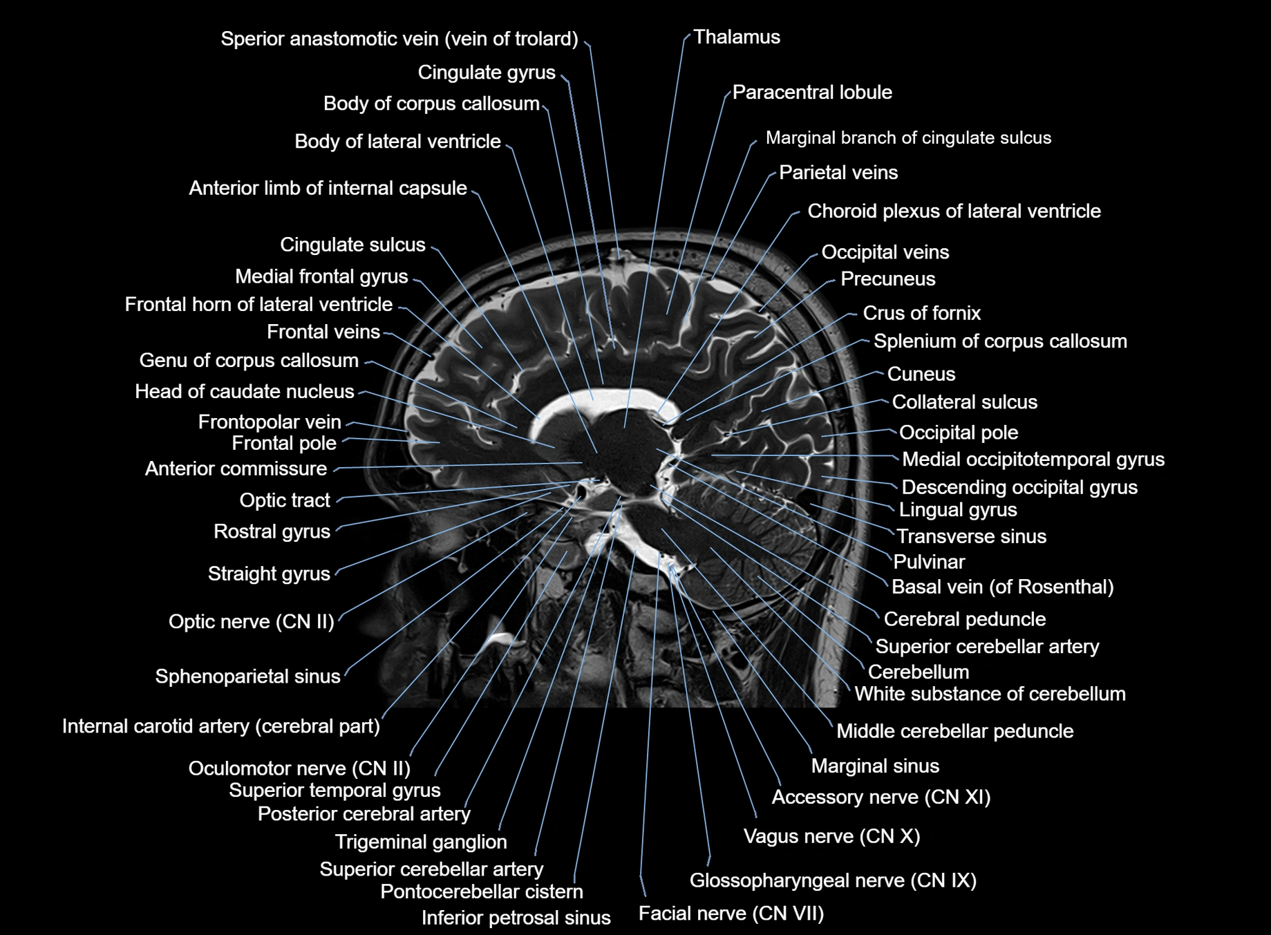 brain sagittal anatomy 3T MRI images -img-00001-00028.webp